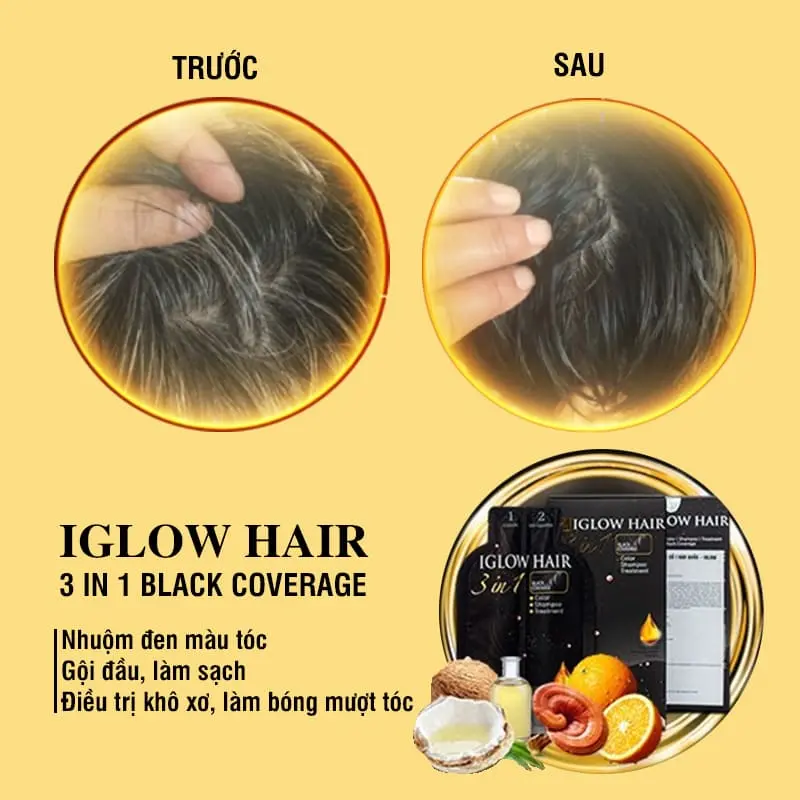 feedback iglow hair - review iglow hair - iglow hair có tốt không - iglow hair có hiệu quả không - 1store.vn - 2