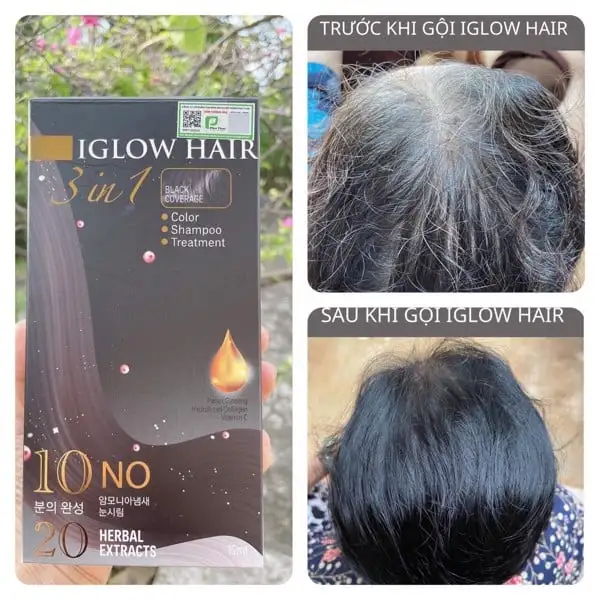 feedback iglow hair - review iglow hair - iglow hair có tốt không - iglow hair có hiệu quả không - 1store.vn - 3