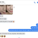 Review Dưỡng Mi Tế Bào Gốc C'choi - Bio-placenta Lash Serum - Punar - 1Store.vn - Hình 10