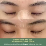 Review Dưỡng Mi Tế Bào Gốc C'choi - Bio-placenta Lash Serum - Punar - 1Store.vn - Hình 13
