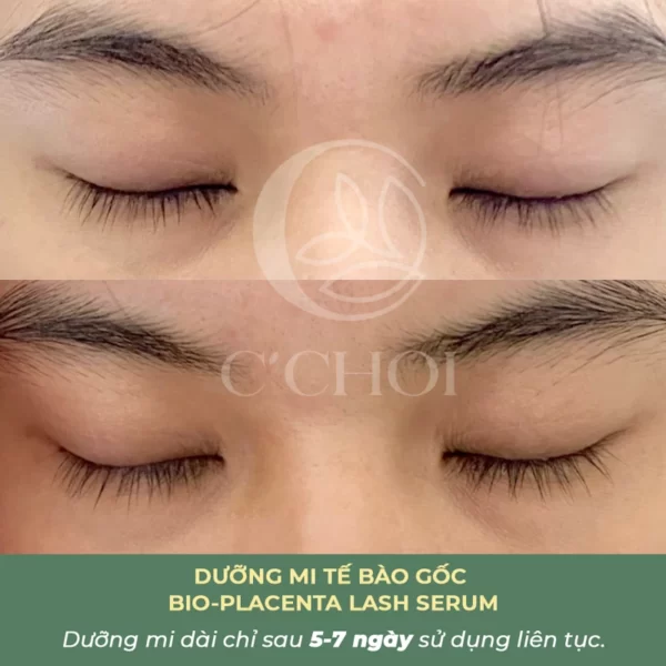 Review Dưỡng Mi Tế Bào Gốc C'choi - Bio-placenta Lash Serum - Punar - 1Store.vn - Hình 13