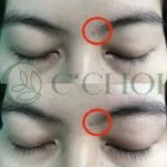 Review Dưỡng Mi Tế Bào Gốc C'choi - Bio-placenta Lash Serum - Punar - 1Store.vn - Hình 2