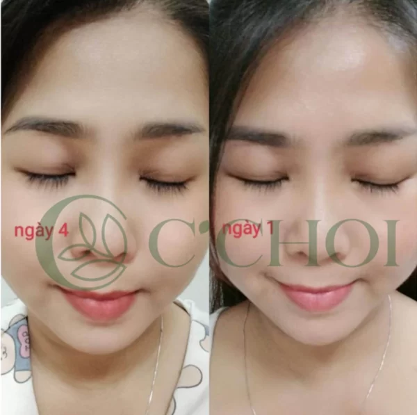 Review Dưỡng Mi Tế Bào Gốc C'choi - Bio-placenta Lash Serum - Punar - 1Store.vn - Hình 7