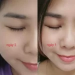 Review Dưỡng Mi Tế Bào Gốc C'choi - Bio-placenta Lash Serum - Punar - 1Store.vn - Hình 8