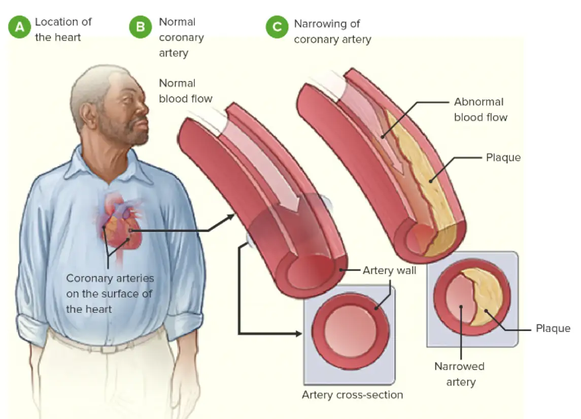 Dầu Cá Giúp Giảm Bệnh Lý Tim Mạch